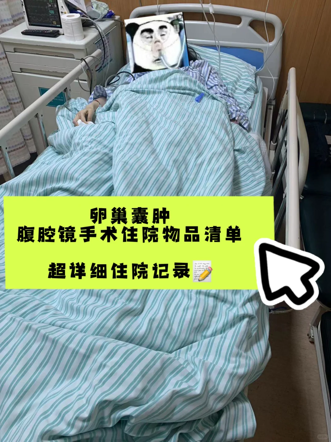 卵巢囊肿（巧囊）腹腔镜住院准备清单🧾,长春申请供卵